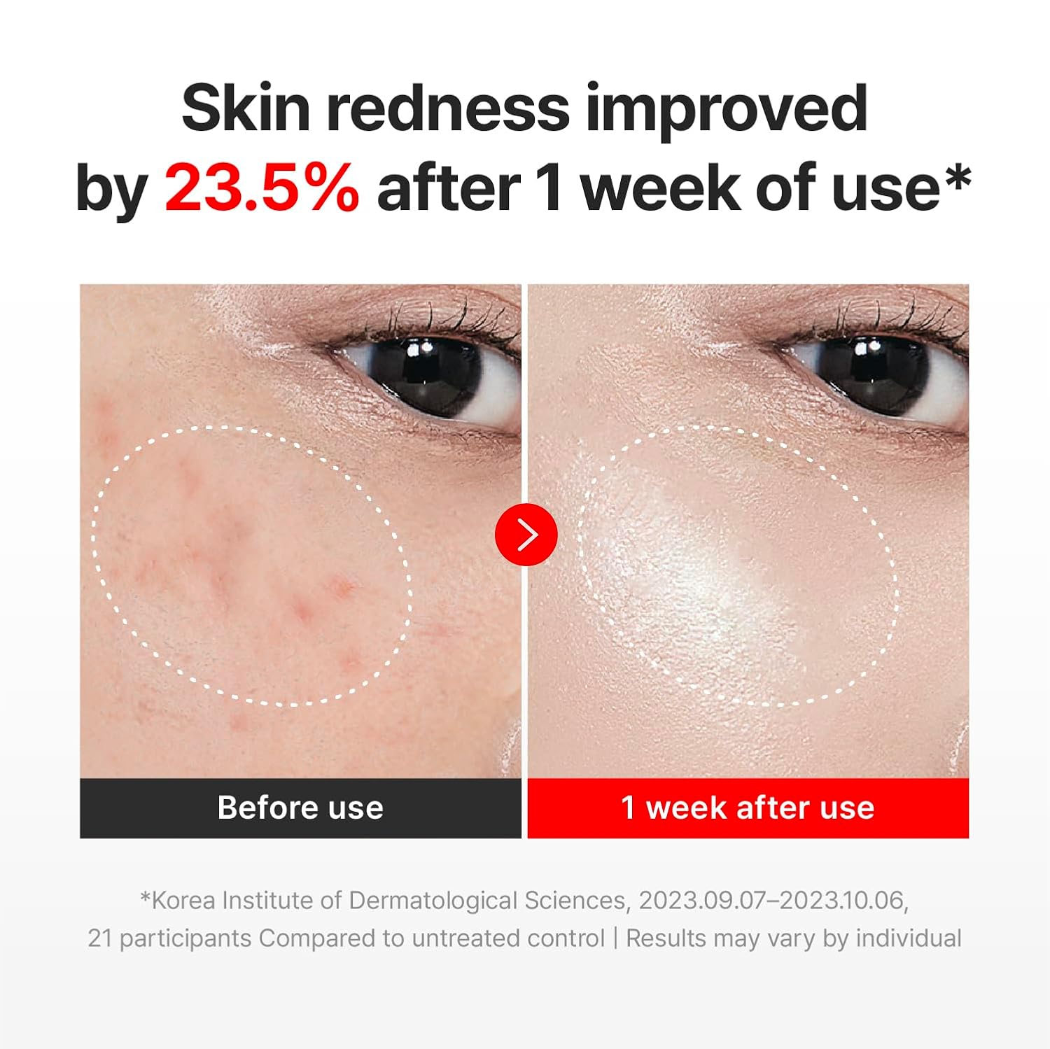 Centellian24 Madeca Cream Time Reverse [50ml]	